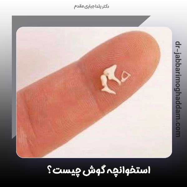 استخوانچه گوش