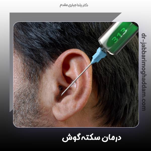 درمان سکته گوش