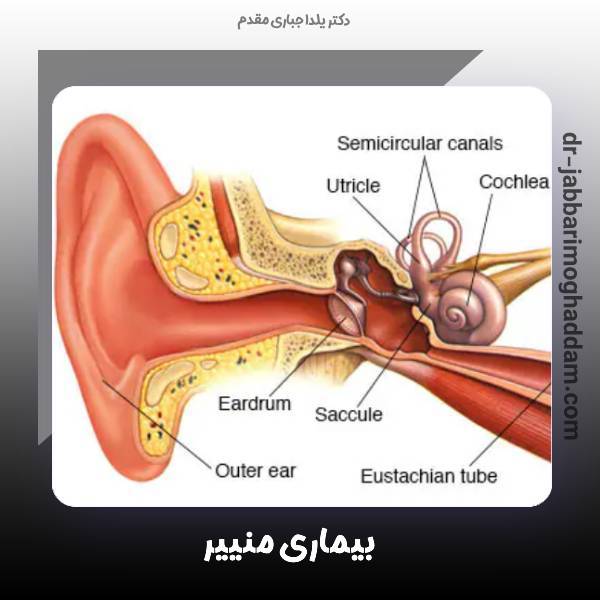بیماری منییر